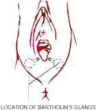 Location of Bartholin's Gland